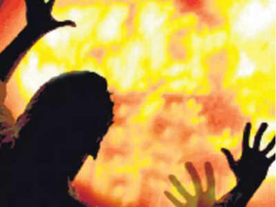 रामलीला में सीता हरण के दौरान भड़की आग, लड़का झुलसा