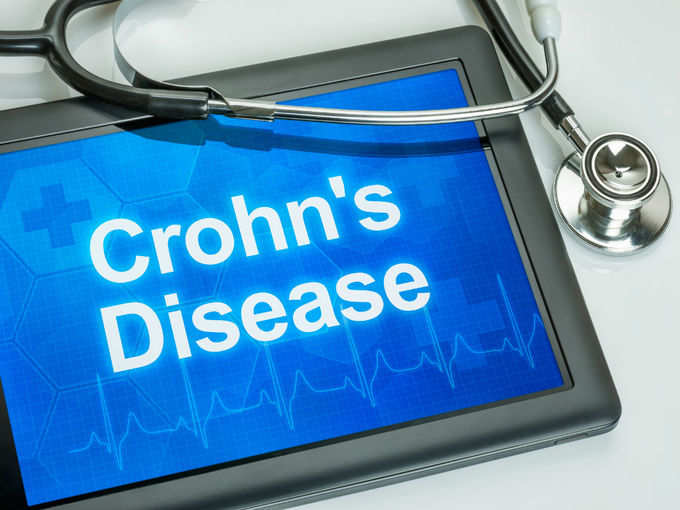 Chrons Diseases