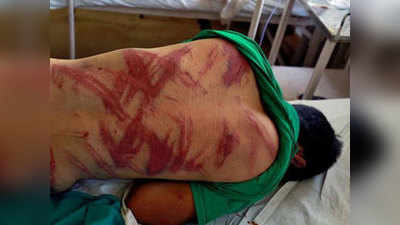 पुलिस की पिटाई में घायल JNU स्टूडेंट के नाम पर कश्मीर के शख्स का पुराना फोटो हो रहा शेयर