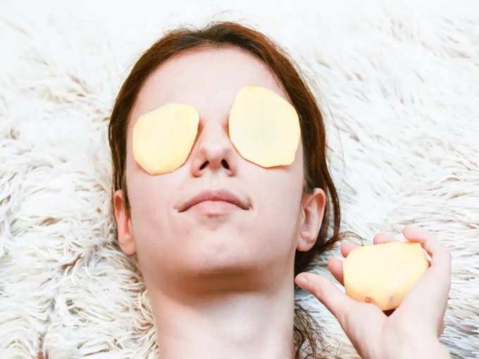 potato for dark circles