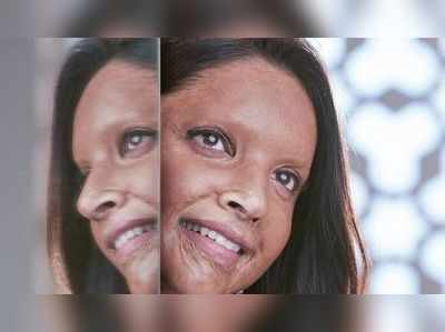 Chhapaak Trailer: उन्होने मेरी सुरत बदली है, मेरा मन नहीं