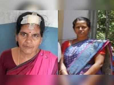 மாமியாரின் தலையை கடித்துக் குதறிய மருமகள்!!