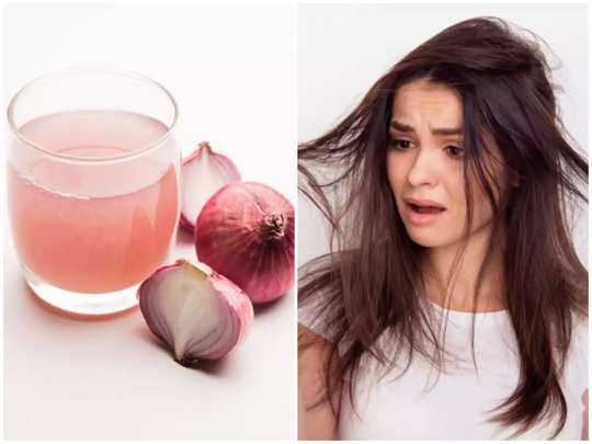 benefits of onion juice for hair, கரு கரு, பளபள கூந்தலுக்கு 100% கியாரண்டி  தரும் இயற்கை பொருள் இதுதானாம்... - how to use onion juice to hair growth at  home - Samayam Tamil