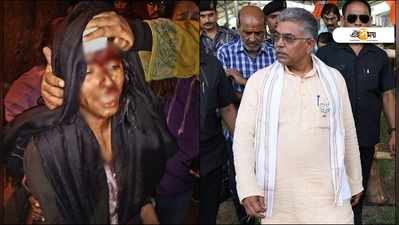 JNU Attack: ‘হামলা সাজানো, ঐশীর ব্যান্ডেজে রক্ত না রং পরীক্ষা হোক!’ দাবি দিলীপ ঘোষের