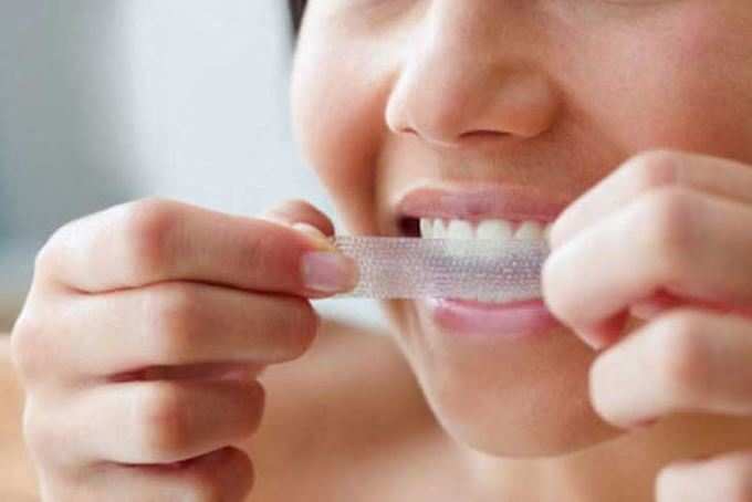 દાંત સફેદ કરવાની પ્રોડક્ટથી થશે નુકસાનઃ