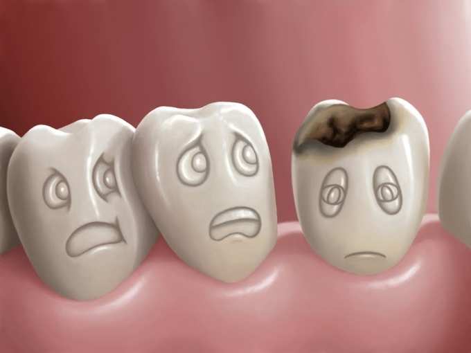 દાંતની સમસ્યા
