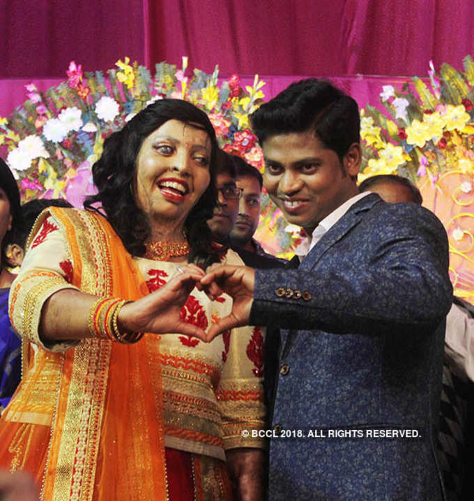 Acid attack victim gets engaged on V-Day