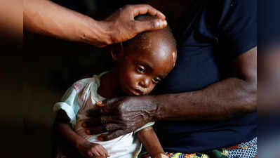 Hunger brings death for children after Congo violence 