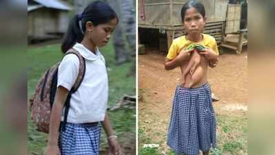 આ છોકરીના પેટની અંદર આવેલા છે બે હાથ, મુશ્કેલીમાં જીવે છે જિંદગી