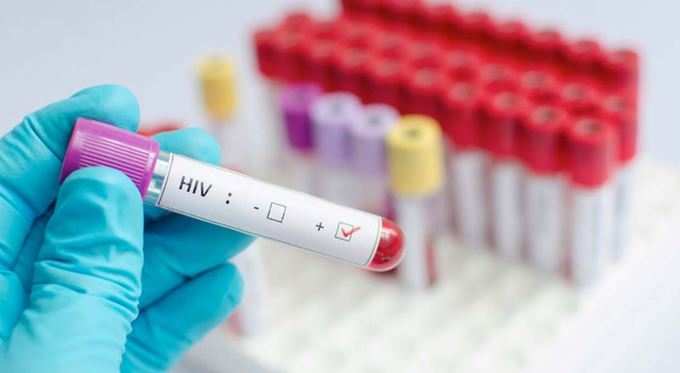 HIVના વાયરસ પર કારગર અસરકર્તા નીવડી રહી છે આ દવા