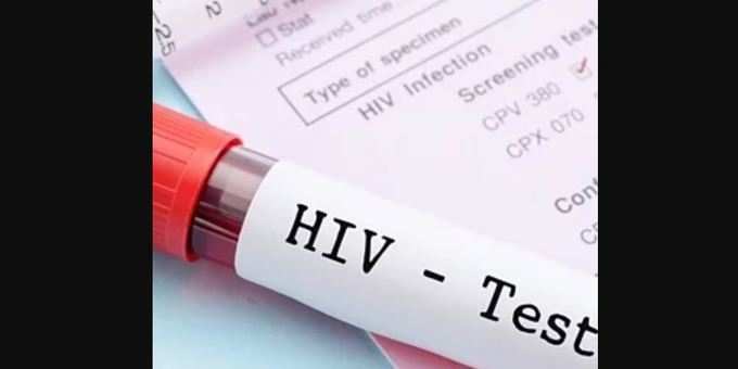 તપાસ કરતા HIV પોઝિટિવ નીકળ્યો