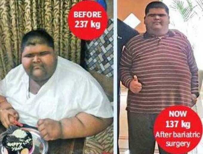 237kg હતું 14 વર્ષના છોકરાનું વજન