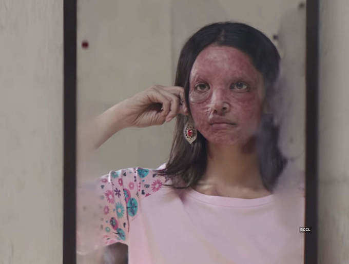 Deepika Padukone turns acid survivor Malti in Chhapaak