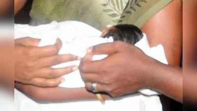 સુરત: ડેન્ગ્યુ મેલેરિયાની શંકાસ્પદ દવા પીવડાવતા ચાર મહિનાની બાળકીનું મોત