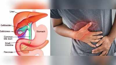 Gallstones : பித்தப்பையில் கல் இருக்கா... நீங்களே கண்டுபிடிக்க எளிய வழி..