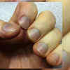நகங்களில் வெள்ளை புள்ளி வந்தால் அதிர்ஷ்டமா?- விஷயம் இதுதான் | Are White  Spots On Nails Lucky Experts Explain | Onlymyhealth Tamil | OnlyMyHealth