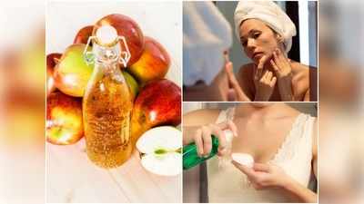 Skin Care Tips: मुंहासे के निशान मिटाकर चेहरे को कर देगा गोरा, घर पर ही ऐसे बनाएं एप्पल साइडर विनेगर टोनर