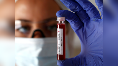 टेस्ट लैब की भारी कमी के कारण अमेरिका में तेजी से फैल रहा कोरोना वायरस