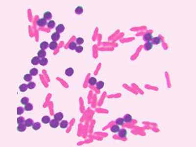 Career In Microbiology: माइक्रोबायॉलजी में खूब है स्कोप, जानें कैसे बनाएं करियर