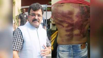 महाराष्ट्र: फेसबुक पर पोस्ट की मॉर्फ्ड तस्वीर, मंत्री जितेंद्र आह्वाड के बंगले में इंजिनियर को डंडों से पीटा