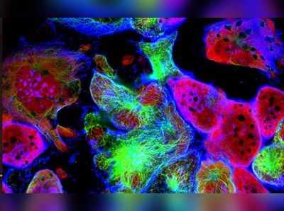 વૈજ્ઞાનિકોએ શોધ્યો એવો વાયરસ જે દરેક પ્રકારનું કેન્સર મટાડી દેશે! 