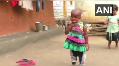 ઓડિશાઃ સતત વધી રહી છે 3 વર્ષની બાળકીના બંને હાથની આંગળીઓ, પરિવાર પણ પરેશાન