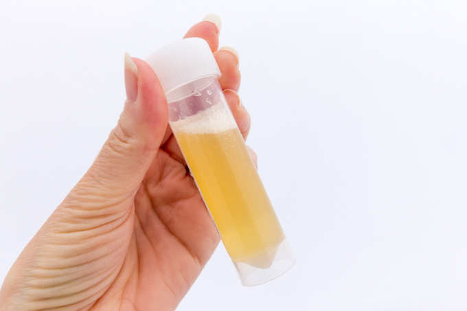 Person holding a urine sample bottle