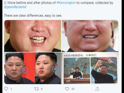 सामने आए North Korea के तानाशाह Kim Jong Un असली या नकली? तस्वीरों में अंतर, छिड़ गई बहस