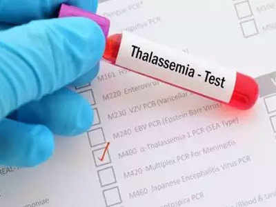 Thalassemia Prevention:जन्म के 4 महीने बाद ही दिखने लगते हैं थैलेसीमिया के लक्षण