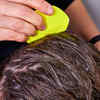 Head lice Causes symptoms and treatments