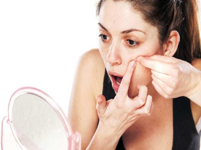 avoid these daily habits that cause acne