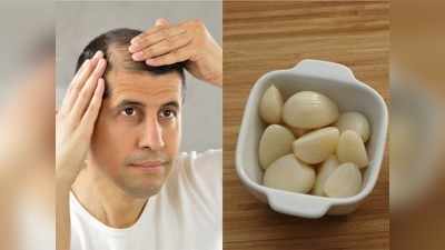 Hair Care Remedies: गंजे सि‍र पर भी उग आएंगे नए बाल, ऐसे करें लहसुन का इस्‍तेमाल