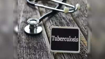 कोरोना ही नहीं...TB से भी आगरा में मचा कोहराम, 54 दिन में 145 मरीजों की मौत