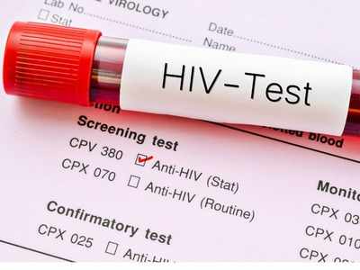 HIV Virus : ఎయిడ్స్‌‌కి మందు ఉందా..  ట్రీట్‌మెంట్ ఏంటో తెలుసుకోండి..