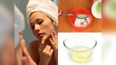 DIY Face Mask: 2 दिन में पुराने से पुराने दाग-धब्बे और मुहांसों के निशान हो जाएंगे दूर, बस लगाएं ये फेस पैक