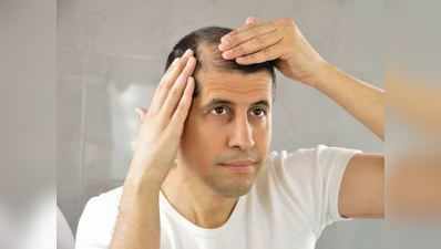 શું તમને પણ માથામાં વાળ ખરવાની સમસ્યા છે તો જાણી લો તેના કારણો