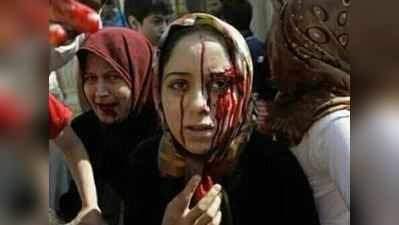 લોહીથી લથબથ આ મહિલાની તસવીરને કાશ્મીરની કહી રહ્યું છે પાકિસ્તાન, જાણો હકીકત