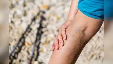 50ની ઉંમર બાદ આ કારણે પગમાં અસહ્ય દુખાવો અને કળતર થાય છે, આ ઉપાયો રાહત આપશે