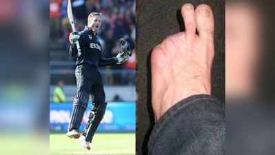 પગમાં માત્ર બે આંગળીઓ સાથે ક્રિકેટ રમે છે આ ધાકડ બેટ્સમેન