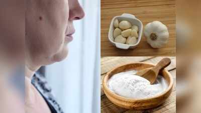 Home Remedies: बिना सर्जरी के हट जाएंगे स्‍किन से मस्से, तुरंत आजमाएं ये घरेलू उपाय