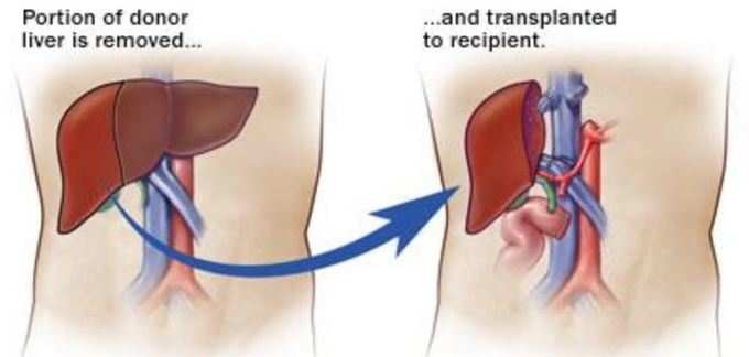 પિતાને દાન કર્યું લીવર