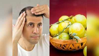 Home Remedies: हफ्तेभर में रुक जाएगा Hair Fall, जल्‍द आजमाएं ये 3 आयुर्वेदिक उपचार