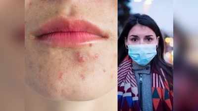 Skin Care Covid 19 : मास्‍क लगाने से चेहरे पर हो रहे हैं एक्‍ने और मुंहासे? तो ये 5 टिप्‍स आएंगे काम