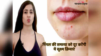 Yoga For Pimple : योग की इन 3 सूक्ष्म क्रियाओं के जरिए दूर करें चेहरे से पिंपल, देखें यह VIDEO