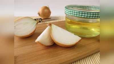 Onion Juice: एक ही हफ्ते में बाल बन जाएंगे काले और घने, जानें कैसे लगाएं प्‍याज का रस