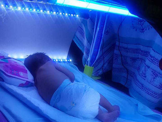 phototherapy machine