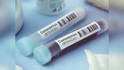 Coronavirus in Jalgaon: जळगावातील मृत्यूदर चिंता वाढवणारा; आतापर्यंत २६३ करोनाबळी