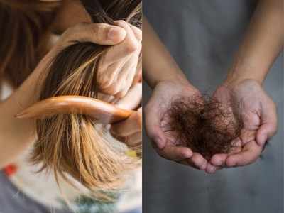 Hair fall remedies: एक ही बार में बालों का गिरना होगा कम, इस घरेलू नुस्‍खे से उग आएंगे नए बाल