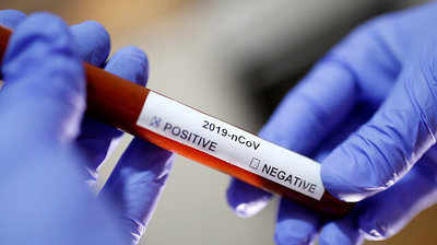 Coronavirus  राज्यात ६ हजार ७१४ नव्या रुग्णांची नोंद; २१३ करोनाबळी