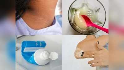 Dark Neck Remedy: 15 मिनट में सालों पुरानी गर्दन पर जमी मैल होगी दूर, टूथपेस्‍ट में मिलाकर लगाएं बस ये 2 रु की चीज